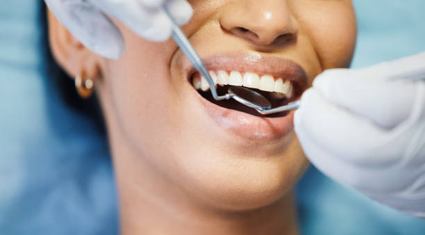 Best Dentist for Tooth Abscess  in Glenwood, IA